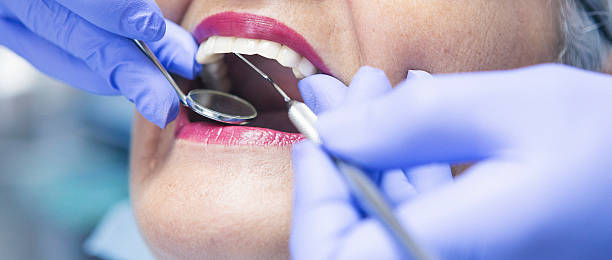 Best Broken or Cracked Tooth Emergency Dentist in Kenmore, NY